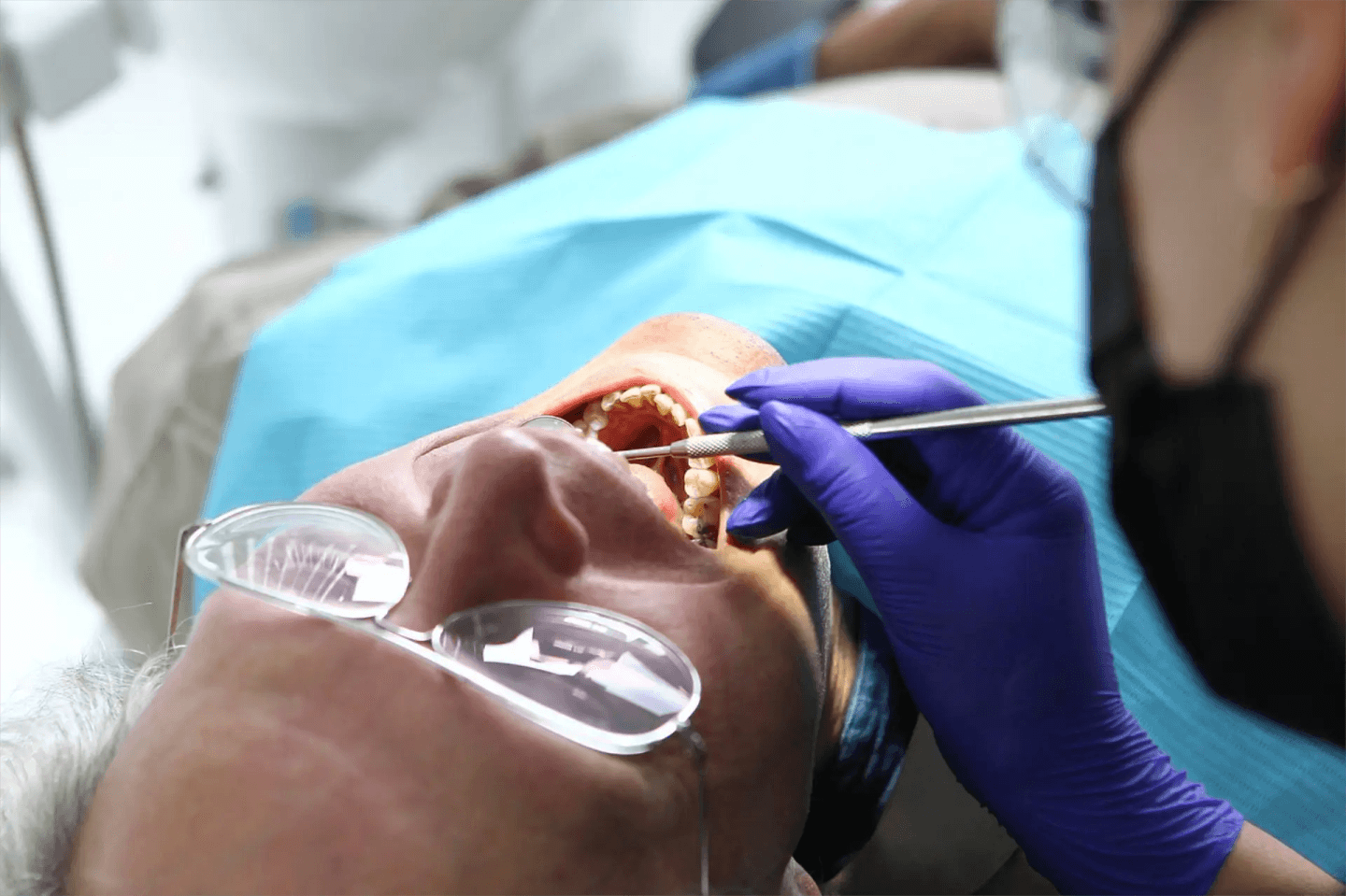 Un dentista con guantes morados examina la boca abierta de un paciente con un instrumental. El paciente, acostado con un babero protector azul, lleva gafas.